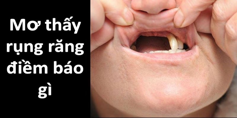 Mơ thấy răng rụng nhưng không hề chảy máu là điềm báo xấu