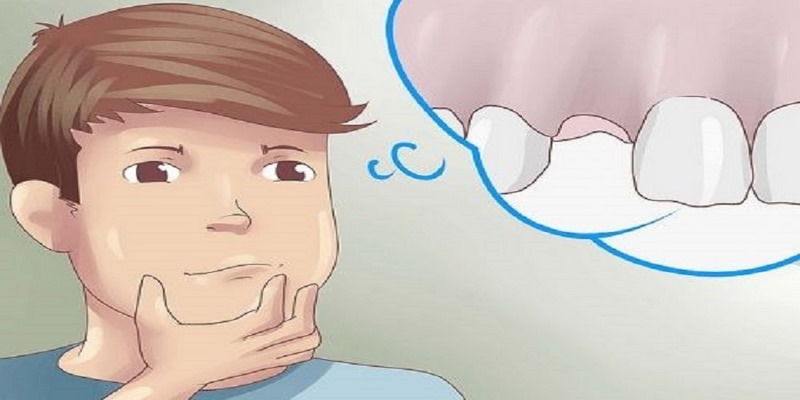 Mơ Thấy Răng Rụng